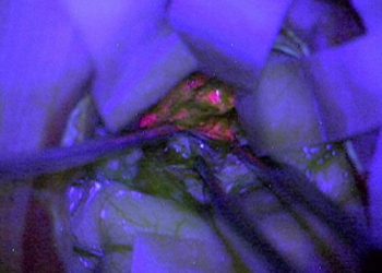 chemical turning brain cells pink