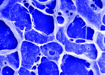 Gel+particles+Zhen+Gu_mid