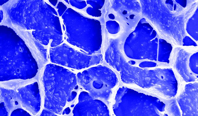 Gel+particles+Zhen+Gu_mid