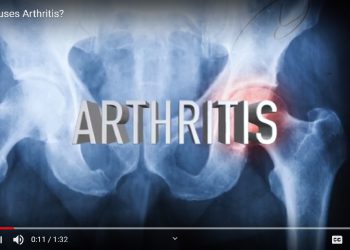 A stem-cell treatment that replaces knee replacements