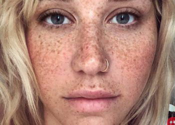 Kesha shows off freckles in new selfie, inspires others