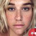 Kesha shows off freckles in new selfie, inspires others