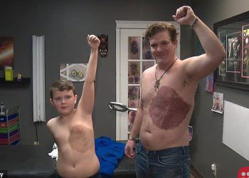 Canadian father gets tattoo identical to son’s birthmark to boost son’s confidence